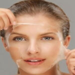 Non age peel therapy