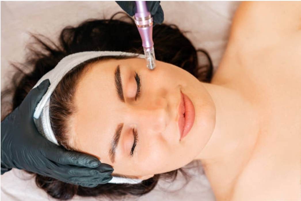 Read more about the article Σεμινάριο Microneedling – (Dermapen) Bio Placenta